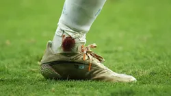 Así quedó el tobillo de Messi.