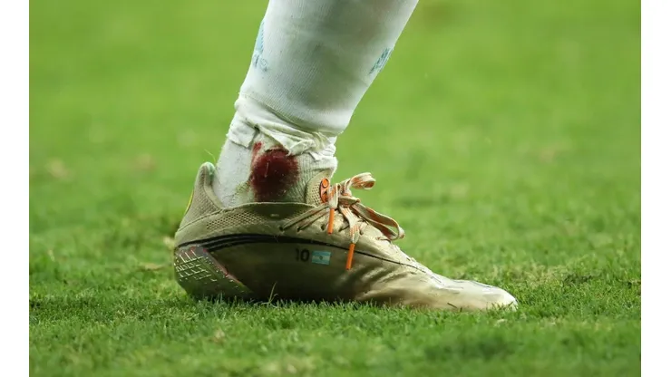 Así quedó el tobillo de Messi.