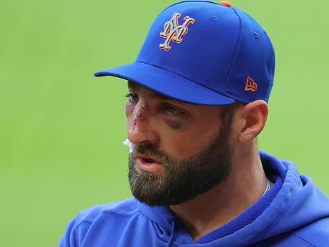 Las consecuencias del brutal pelotazo para figura de New York Mets