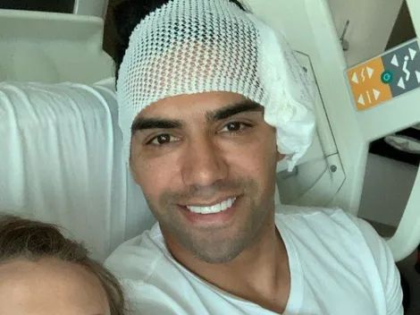 Se conoció la incapacidad que tendrá Falcao García, tras su fractura de cara