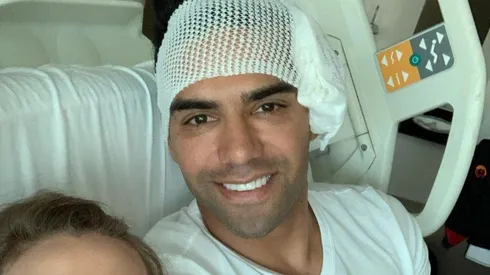 Se conoció la incapacidad que tendrá Falcao García, tras su fractura de cara