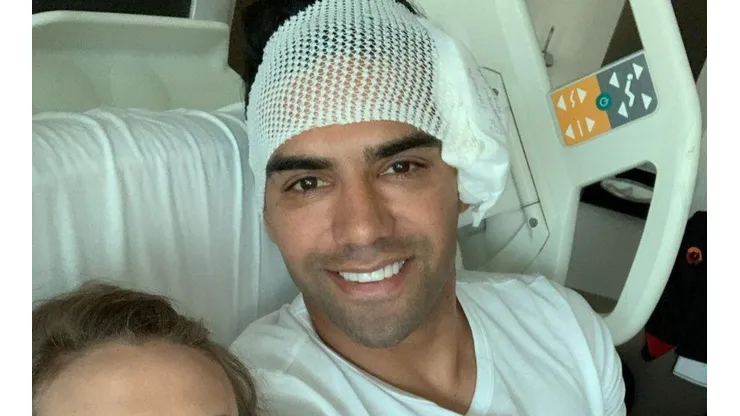 Se conoció la incapacidad que tendrá Falcao García, tras su fractura de cara