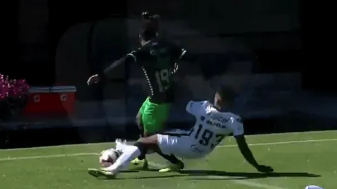 Terrible fractura en la Liga MX Sub-20.