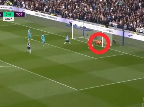 No apto para impresionables: la lesión de Hugo Lloris