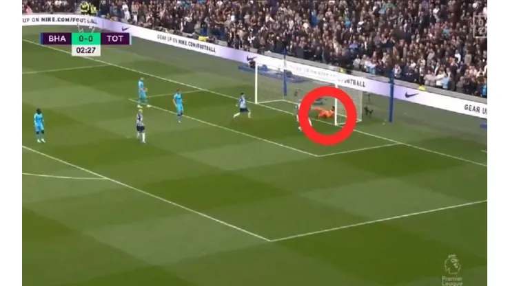 No apto para impresionables: la lesión de Hugo Lloris