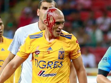 "Contra América es un partido de matar o morir"