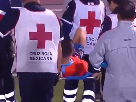 Benedetti salió lesionado y preocupa en América