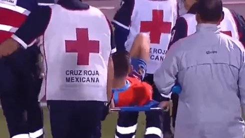 Benedetti salió lesionado y preocupa en América