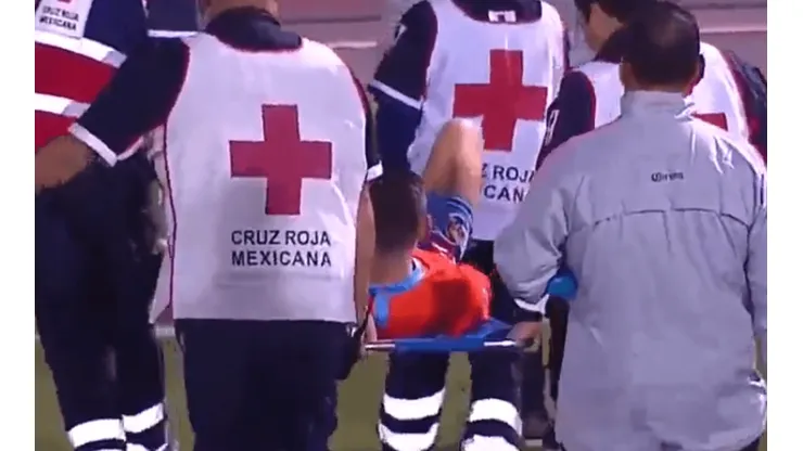 Benedetti salió lesionado y preocupa en América