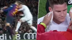 Gameiro tuvo que salir tras el cabezazo.