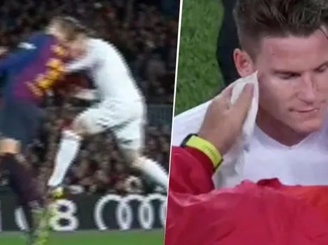 Parece maquillado: así le quedó la cara a Gameiro después de su choque con Piqué