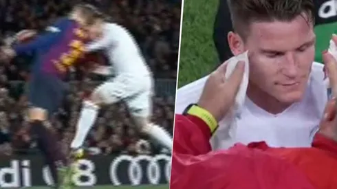 Gameiro tuvo que salir tras el cabezazo.