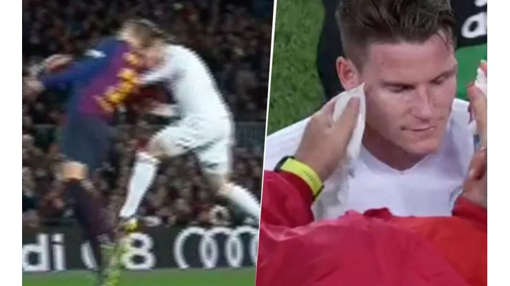 Gameiro tuvo que salir tras el cabezazo.