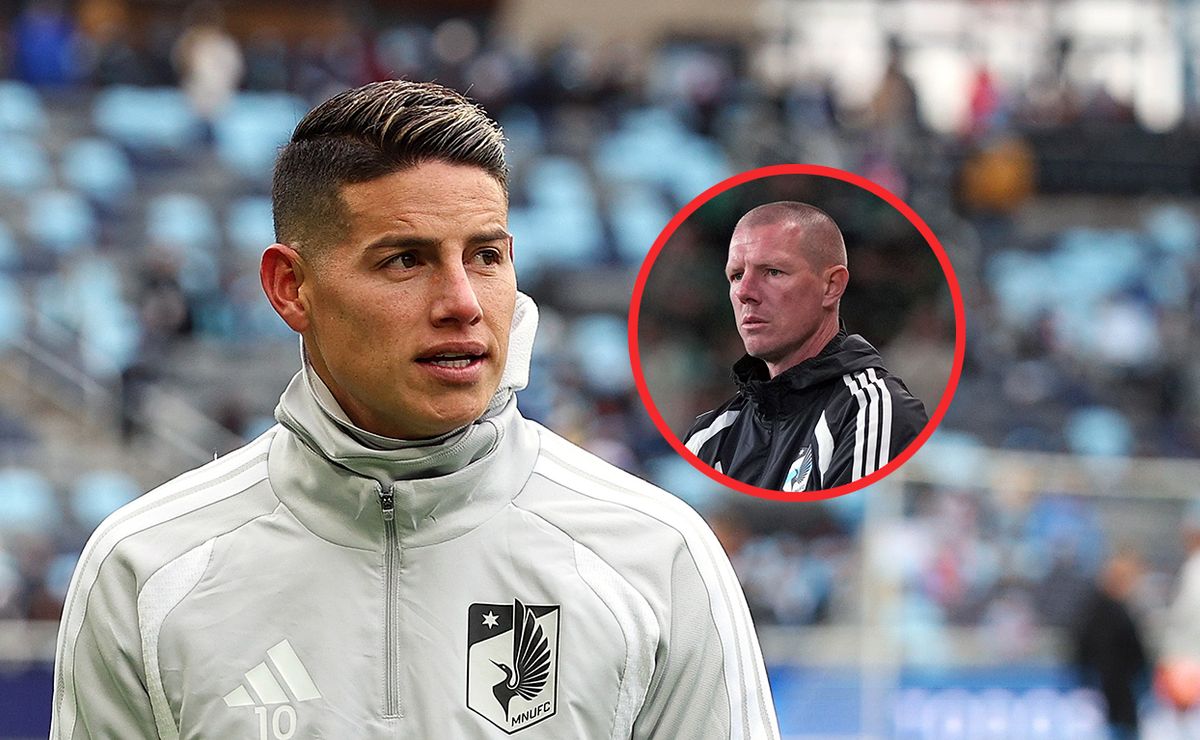 El técnico de Minnesota United reconoce lo difícil que es jugar sin James Rodríguez: “Te castigan”