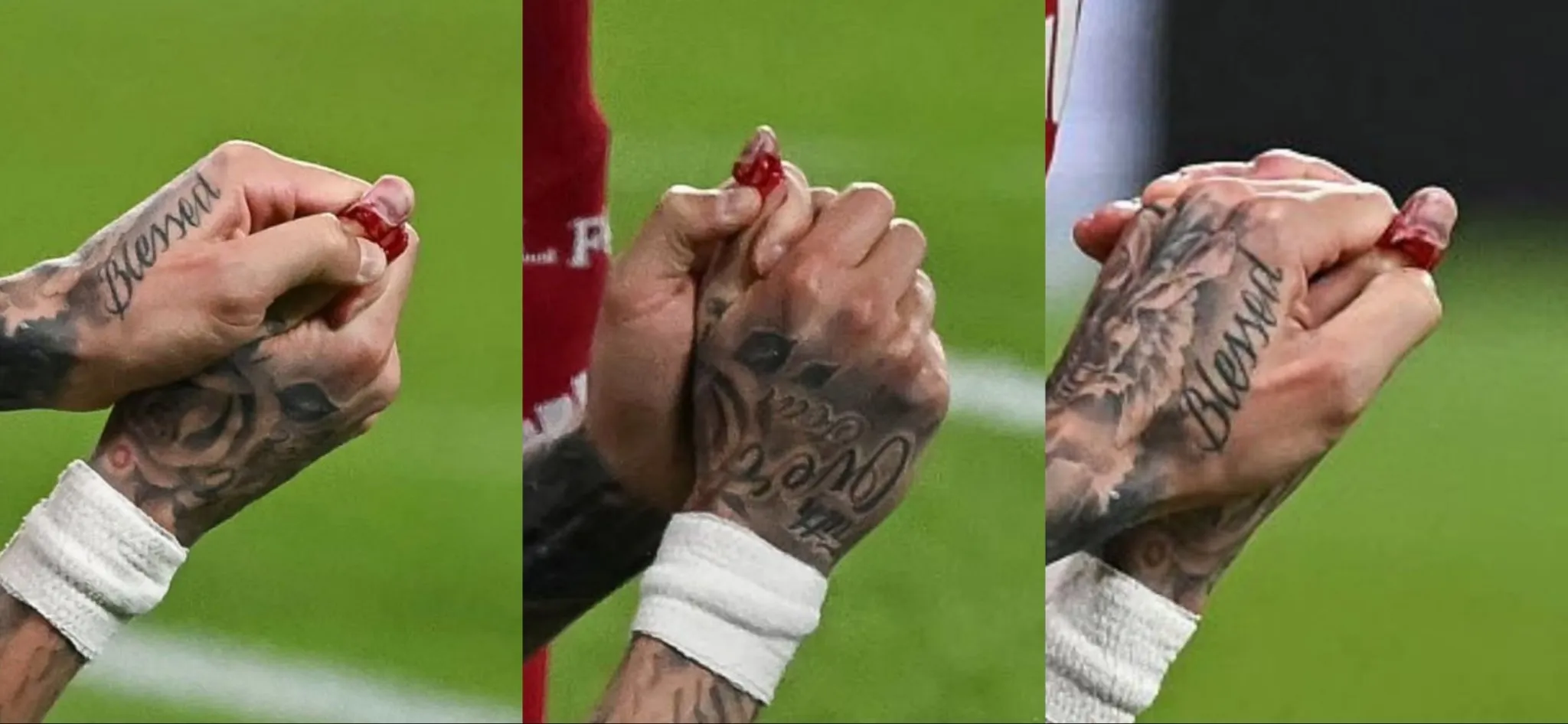 El dedo de Noa Langa tras su lesión.