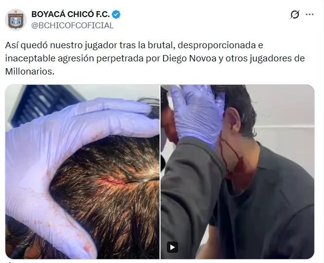 La denuncia de Boyacá Chicó. (Captura de pantalla)