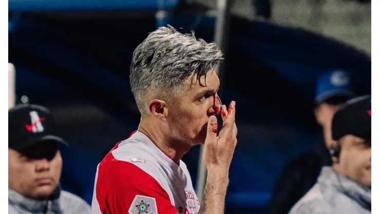 La agresión a Daniel Torres en DIM vs. Santa Fe.