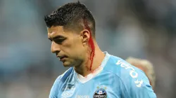 Foto: Pedro H. Tesch/AGIF - Suárez traz preocupação ao Grêmio.