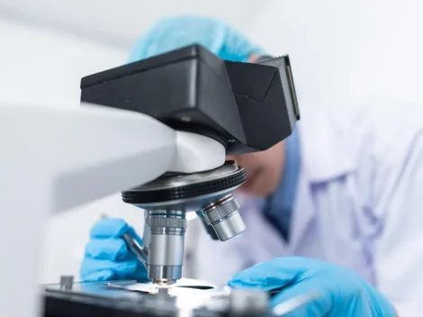 Refrigerante aumenta chances de desenvolver calvície