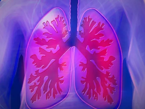 Cura do câncer de pulmão: Medicamento está em fase de testes