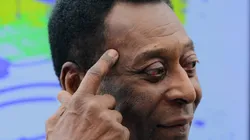 Foto: Moises Nascimento/AGIF - Situação de Pelé é atualizada