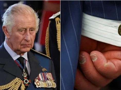 Dedos inchados e vermelhos do Rei Charles III chama a atenção; Entenda o porquê