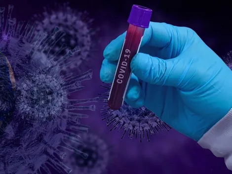 Covid-19: SP tem primeiro óbito confirmado pela subvariante BQ.1