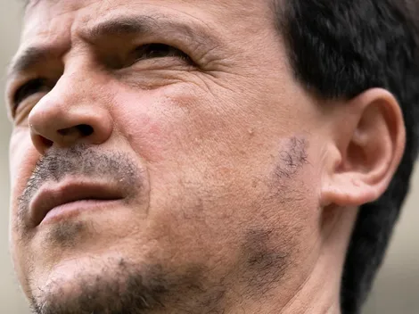 Diniz se rende a reserva do Fluminense e situação repercute entre os tricolores na web