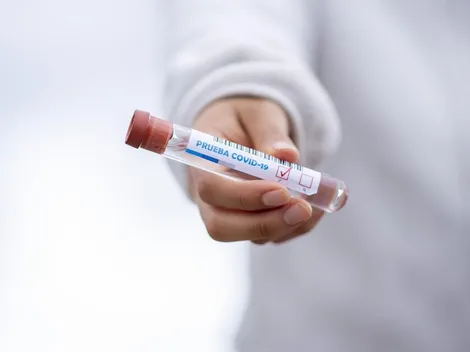 Autoteste de Covid-19: como identificar o resultado e outras dúvidas