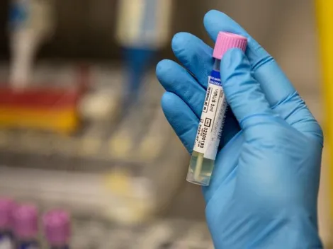 Varíola dos macacos: Brasil tem 21 casos confirmados da doença