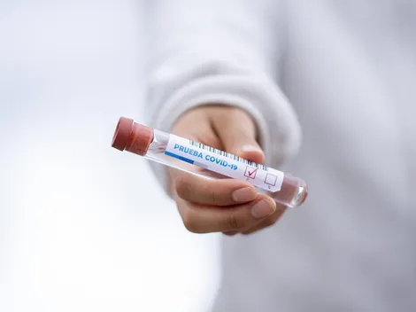 Governo deixa de exigir teste de Covid para entrada no país