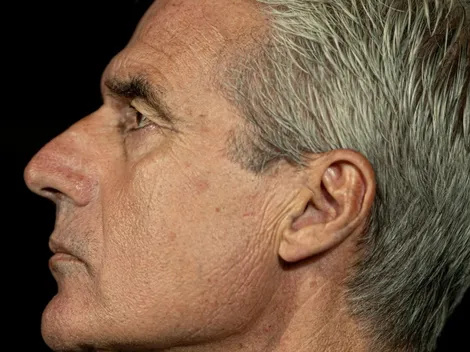 Luís Castro não ignora as vaias e expõe problema no Botafogo