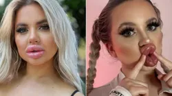 Modelo do OnlyFans apostou em plásticas. Foto: Reprodução/Instagram oficial Jessy Bunny