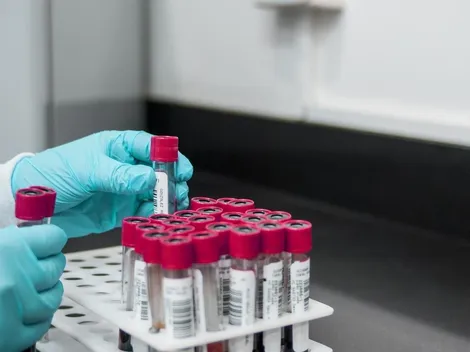 Alzheimer: novo exame de sangue que chega ao Brasil pode ajudar na identificação da doença