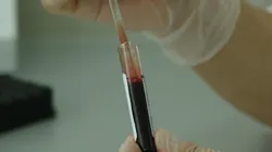 Químicos estão na nossa corrente sanguínea e podem persistir por anos. Foto: Pixabay.