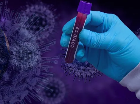 Covid-19: Especialistas alertam que medidas de proteção devem continuar apesar do avanço da vacinação