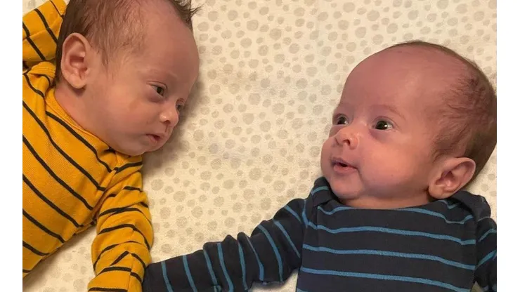 Bebês estão com 3 meses. Foto: Reprodução/Instagram/@osgemeosmigueledavi