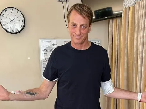Ídolo do skate mundial, Tony Hawk sofre acidente, quebra o fêmur e aparece de muletas no hospital
