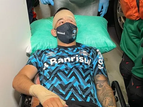 Grêmio atualiza quadro de Villasanti após diagnóstico de traumatismo craniano e concussão