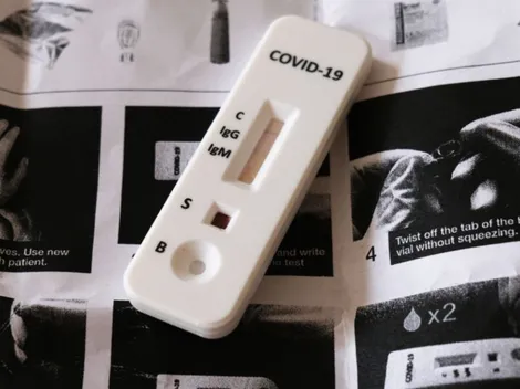 Covid-19: Anvisa registra 30 pedidos para registros de autoteste