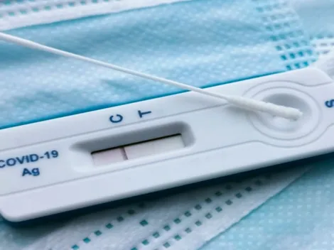 Ministério da Saúde não autoriza distribuição dos autotestes pelo SUS; recurso será comercializado em farmácias