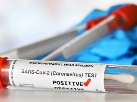 Procon de São Paulo notifica farmácias sobre a falta de testes de Covid-19