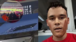 Filho de vítima na UTI acusou São Paulo de negligência após placa de ferro cair em torcedores contra Libertad - Fotos: Reprodução/X