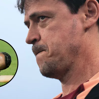 Fernando Diniz prega cautela com lesão de Kayke no Corinthians