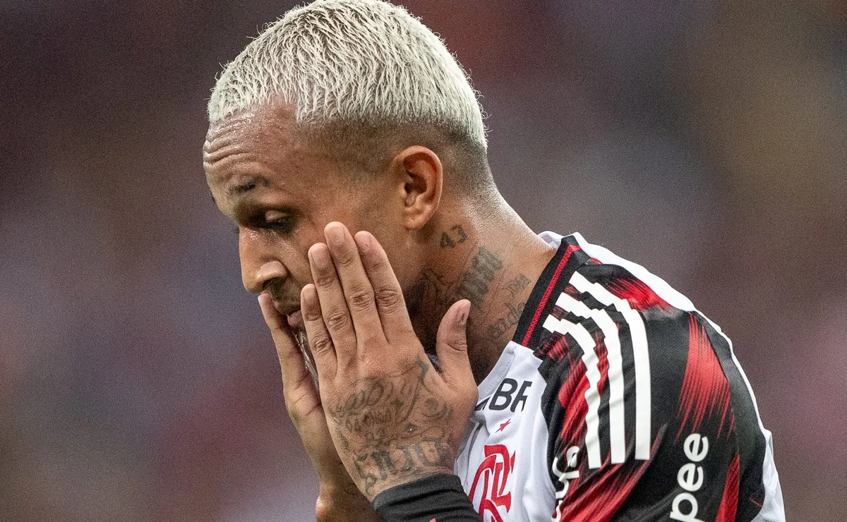 Ex-Flamengo, Wesley é flagrado mancando muito após Brasil x Egito e eleva risco de corte
