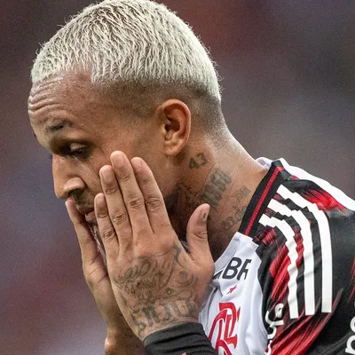 Wesley é flagrado mancando muito e eleva risco de corte