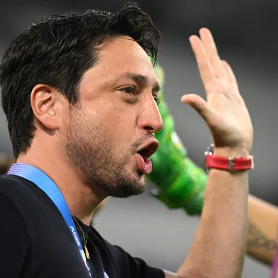 Arthur Elias revela como vê a Copa Feminina no Brasil
